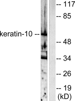 Cytokeratin 10 rabbit pAb Antibody