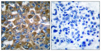 Cytokeratin 15 rabbit pAb Antibody