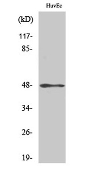 Cytokeratin 17 rabbit pAb Antibody