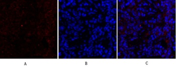 Cytokeratin 18 rabbit pAb Antibody