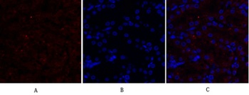 Cytokeratin 18 rabbit pAb Antibody