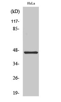Cytokeratin 18 rabbit pAb Antibody