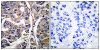 Cytokeratin 20 rabbit pAb