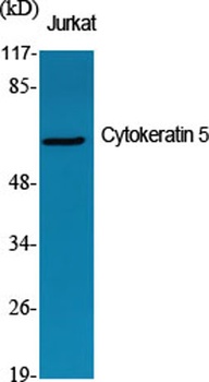 Cytokeratin 5 rabbit pAb Antibody