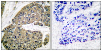 Cytokeratin 5 rabbit pAb Antibody