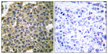 Cytokeratin 7 rabbit pAb Antibody