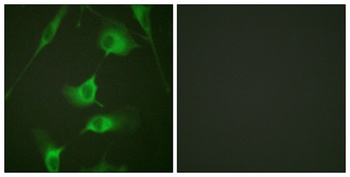 Cytokeratin 8 rabbit pAb Antibody