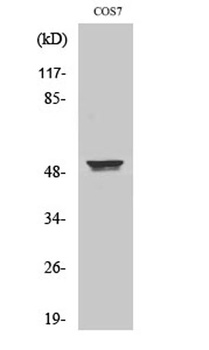 Cytokeratin 8 rabbit pAb Antibody