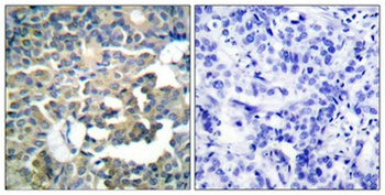 Cytokeratin 8 rabbit pAb Antibody