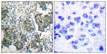 Cytokeratin 8 rabbit pAb Antibody