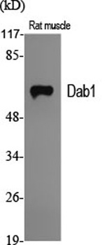 Dab1 rabbit pAb Antibody