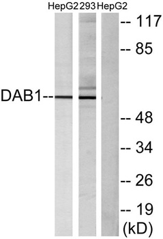 Dab1 rabbit pAb Antibody