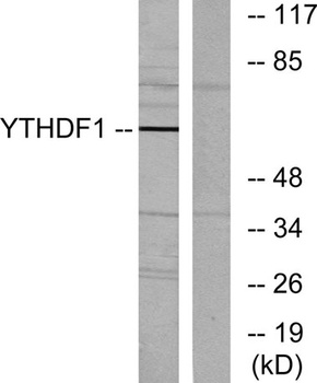 DACA-1 rabbit pAb Antibody