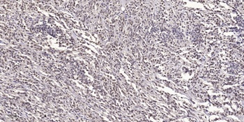 DACA-1 rabbit pAb Antibody