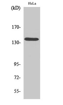 DDX8 rabbit pAb Antibody