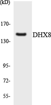DDX8 rabbit pAb Antibody