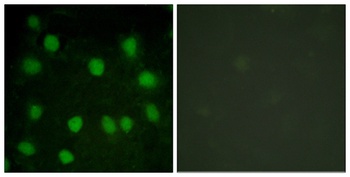 Dematin rabbit pAb Antibody