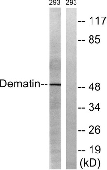 Dematin rabbit pAb Antibody