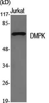 DMPK rabbit pAb Antibody