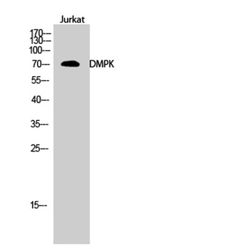 DMPK rabbit pAb Antibody