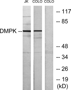 DMPK rabbit pAb Antibody