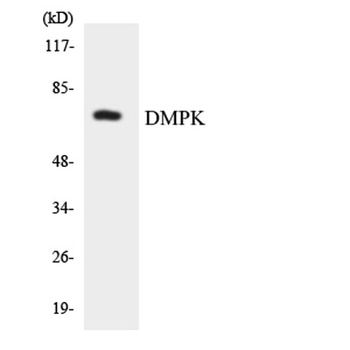 DMPK rabbit pAb Antibody
