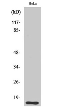 DOC-1 rabbit pAb Antibody