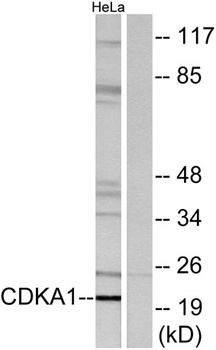 DOC-1 rabbit pAb Antibody