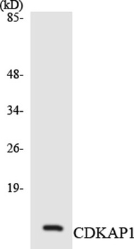 DOC-1 rabbit pAb Antibody