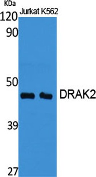 DRAK2 rabbit pAb Antibody