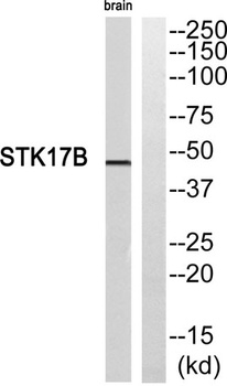 DRAK2 rabbit pAb Antibody