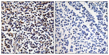 DRAK2 rabbit pAb Antibody