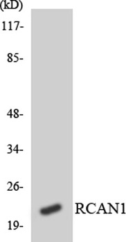 DSCR 1 rabbit pAb Antibody