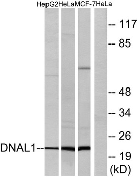 Dynein LC 1 rabbit pAb Antibody