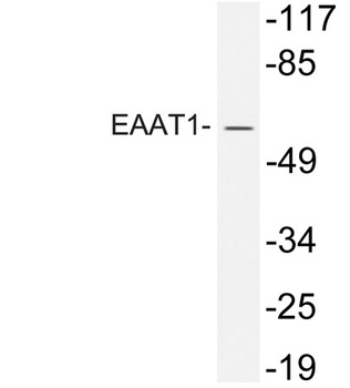 EAAT1 rabbit pAb Antibody