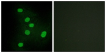 EAR2 rabbit pAb Antibody
