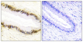 EAR2 rabbit pAb Antibody
