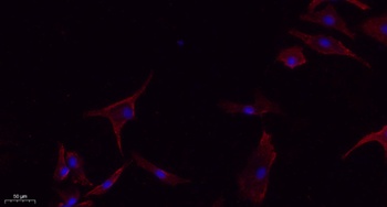 E-cadherin rabbit pAb Antibody