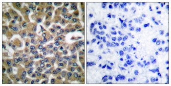 EF-2 rabbit pAb Antibody