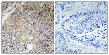 Eg5 rabbit pAb Antibody