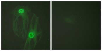 Eg5 rabbit pAb Antibody