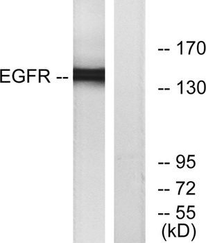 EGFR rabbit pAb