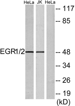 Egr-2 rabbit pAb Antibody