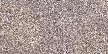 Egr-2 rabbit pAb Antibody