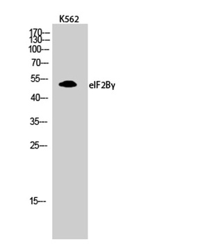eIF2Bγ rabbit pAb Antibody