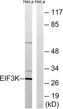 eIF3K rabbit pAb Antibody