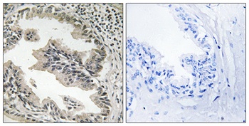 Endophilin B2 rabbit pAb Antibody