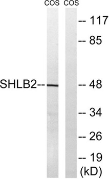 Endophilin B2 rabbit pAb Antibody