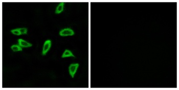 EP3 rabbit pAb Antibody