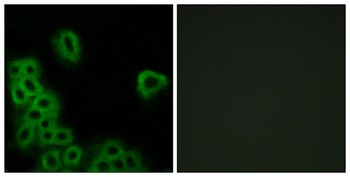 EP4 rabbit pAb Antibody